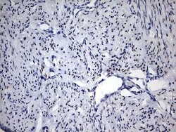 PGR Mouse anti-Human, Clone: OTI20A1, lyophilized, TrueMAB 100 &mu;g; Unconjugated:Antibodies,