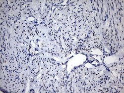 PGR Monoclonal Antibody (OTI20A1), TrueMAB , OriGene 100 &mu;L; Unconjugated:Antibodies,
