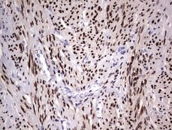 PGR Mouse anti-Human, Clone: OTI2C2, lyophilized, TrueMAB 100 &mu;g; Unconjugated:Antibodies,