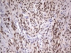 PGR Monoclonal Antibody (OTI2C2), TrueMAB , OriGene:Antibodies:Primary