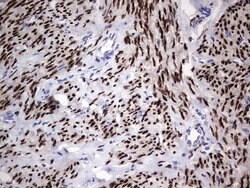 PGR Mouse anti-Human, Clone: OTI2C2, lyophilized, TrueMAB 100 &mu;g; Unconjugated:Antibodies,