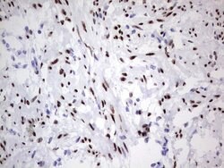PGR Monoclonal Antibody (OTI4C12), TrueMAB , OriGene:Antibodies:Primary