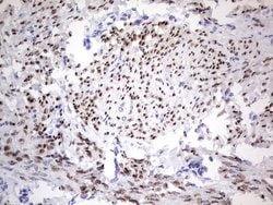 PGR Monoclonal Antibody (OTI4C12), TrueMAB , OriGene 100 &mu;L; Unconjugated:Antibodies,