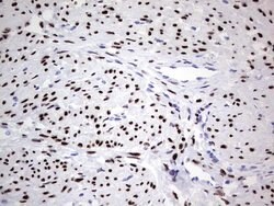 PGR Mouse anti-Human, Clone: OTI34G6, lyophilized, TrueMAB 100 &mu;g; Unconjugated:Antibodies,
