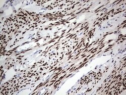 PGR Mouse anti-Human, Clone: OTI34G6, lyophilized, TrueMAB 100 &mu;g; Unconjugated:Antibodies,