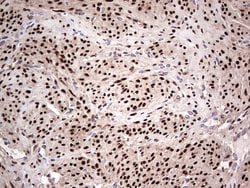 PGR Mouse anti-Human, Clone: OTI31D9, lyophilized, TrueMAB 100 &mu;g; Unconjugated:Antibodies,
