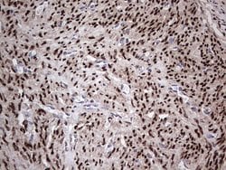 PGR Monoclonal Antibody (OTI31D9), TrueMAB , OriGene 30 &mu;L; Unconjugated:Antibodies,