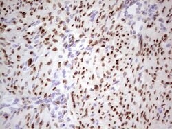 PGR Monoclonal Antibody (OTI24D6), TrueMAB , OriGene:Antibodies:Primary