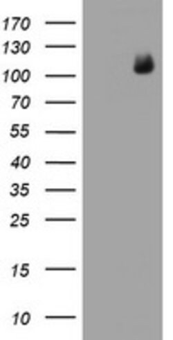 PGR Mouse anti-Human, Clone: OTI11G9, lyophilized, TrueMAB 100 &mu;g; Unconjugated:Antibodies,