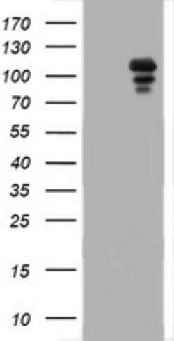 PGR Mouse anti-Human, Clone: OTI1G7, lyophilized, TrueMAB 100 &mu;g; Unconjugated:Antibodies,