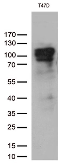 PGR Monoclonal Antibody (OTI1G7), TrueMAB , OriGene 100 &mu;L; Unconjugated:Antibodies,