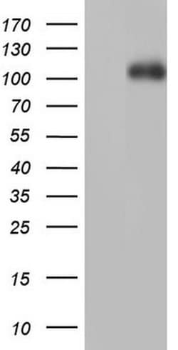 PGR Monoclonal Antibody (OTI1F8), TrueMAB , OriGene 100 &mu;L; Unconjugated:Antibodies,