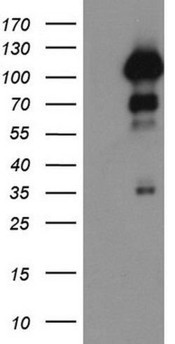 PGR Monoclonal Antibody (OTI12D1), TrueMAB , OriGene 100 &mu;L; Unconjugated:Antibodies,