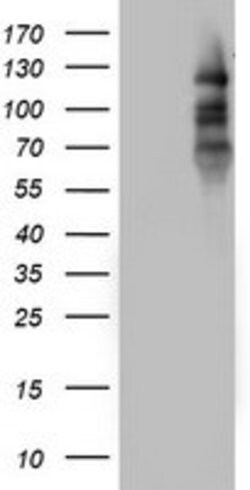PGR Mouse anti-Human, Clone: OTI4B3, lyophilized, TrueMAB 100 &mu;g; Unconjugated:Antibodies,