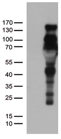 PGR Monoclonal Antibody (OTI11E8), TrueMAB , OriGene 100 &mu;L; Unconjugated:Antibodies,