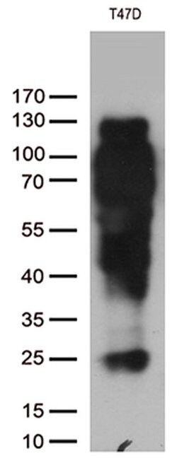 PGR Monoclonal Antibody (OTI11E8), TrueMAB , OriGene 100 &mu;L; Unconjugated:Antibodies,