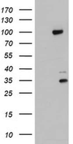 PGR Monoclonal Antibody (OTI5E8), TrueMAB , OriGene 100 &mu;L; Unconjugated:Antibodies,