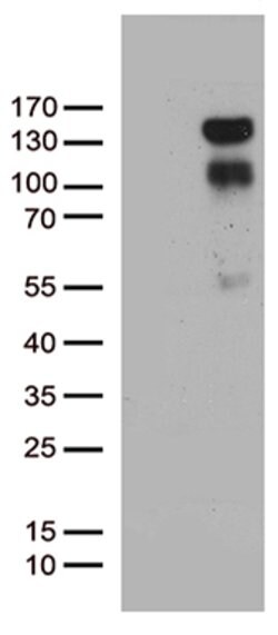 PGR Mouse anti-Human, Clone: OTI4D5, lyophilized, TrueMAB 100 &mu;g; Unconjugated:Antibodies,