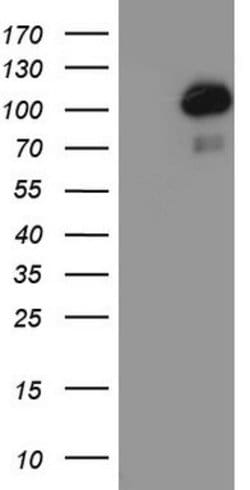 PGR Mouse anti-Human, Clone: OTI20A1, lyophilized, TrueMAB 100 &mu;g; Unconjugated:Antibodies,