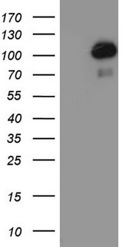 PGR Monoclonal Antibody (OTI20A1), TrueMAB , OriGene 100 &mu;L; Unconjugated:Antibodies,
