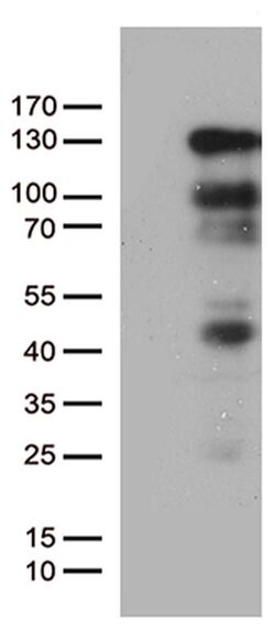 PGR Monoclonal Antibody (OTI7A9), TrueMAB , OriGene:Antibodies:Primary