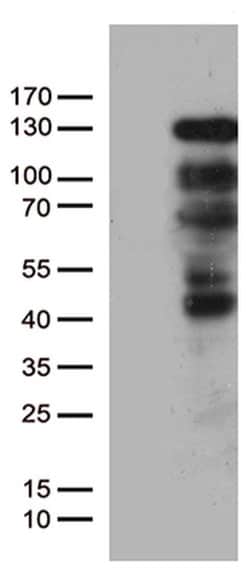 PGR Monoclonal Antibody (OTI7G7), TrueMAB , OriGene 100 &mu;L; Unconjugated:Antibodies,