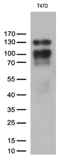 PGR Monoclonal Antibody (OTI7G7), TrueMAB , OriGene 100 &mu;L; Unconjugated:Antibodies,