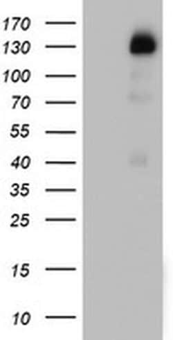 PGR Monoclonal Antibody (OTI5C12), TrueMAB , OriGene:Antibodies:Primary