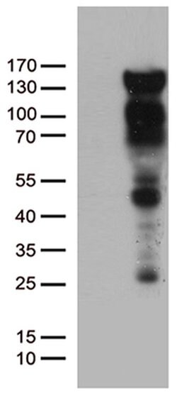 PGR Monoclonal Antibody (OTI18B12), TrueMAB , OriGene:Antibodies:Primary
