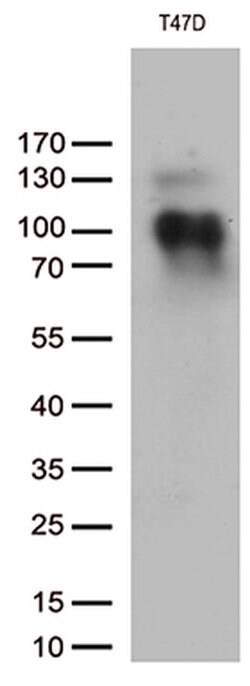 PGR Monoclonal Antibody (OTI18B12), TrueMAB , OriGene 100 &mu;L; Unconjugated:Antibodies,