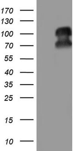 PGR Monoclonal Antibody (OTI2C2), TrueMAB , OriGene 100 &mu;L; Unconjugated:Antibodies,