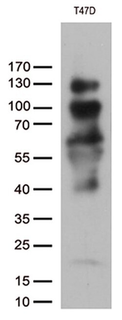 PGR Monoclonal Antibody (OTI2C2), TrueMAB , OriGene 100 &mu;L; Unconjugated:Antibodies,