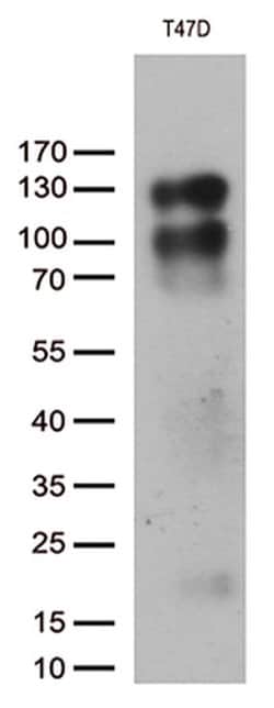 PGR Monoclonal Antibody (OTI4C12), TrueMAB , OriGene:Antibodies:Primary