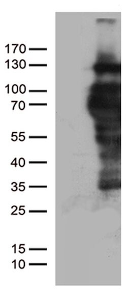 PGR Mouse anti-Human, Clone: OTI34G6, lyophilized, TrueMAB 100 &mu;g; Unconjugated:Antibodies,
