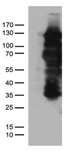 PGR Mouse anti-Human, Clone: OTI31D9, lyophilized, TrueMAB 100 &mu;g; Unconjugated:Antibodies,