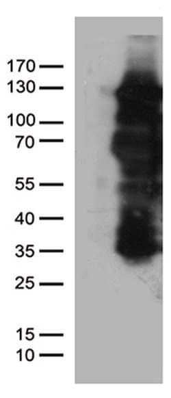 PGR Monoclonal Antibody (OTI31D9), TrueMAB , OriGene 30 &mu;L; Unconjugated:Antibodies,