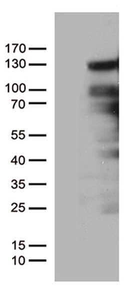 PGR Monoclonal Antibody (OTI24D6), TrueMAB , OriGene 30 &mu;L; Unconjugated:Antibodies,