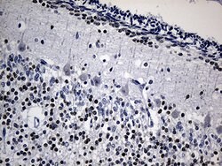 PHF20L1 Monoclonal Antibody (OTI3F3), TrueMAB , OriGene:Antibodies:Primary