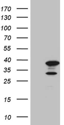 PHF20L1 Monoclonal Antibody (OTI1B4), TrueMAB , OriGene:Antibodies:Primary