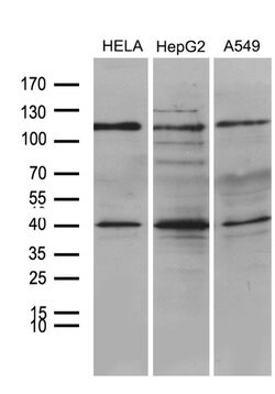 PHF20L1 Monoclonal Antibody (OTI1B4), TrueMAB , OriGene:Antibodies:Primary