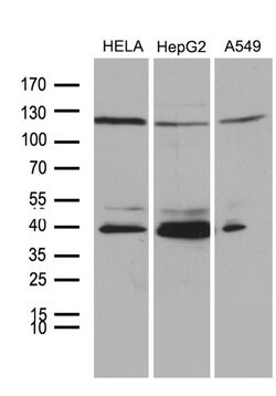 PHF20L1 Monoclonal Antibody (OTI6G6), TrueMAB , OriGene 30 &mu;L | Buy Online | Origene Technologies | Fisher Scientific