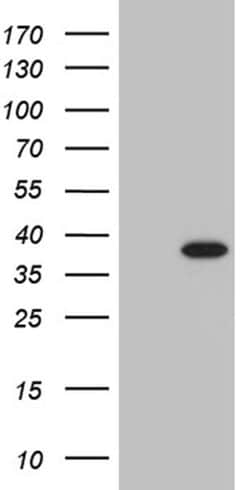PHF20L1 Monoclonal Antibody (OTI1F4), TrueMAB , OriGene 30 &mu;L; Unconjugated:Antibodies,