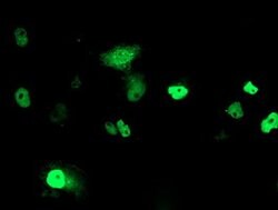 PHF21B Mouse anti-Human, Clone: OTI4C5, lyophilized, TrueMAB 100 &mu;g;