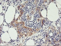 PHF21B Mouse anti-Human, Clone: OTI3D1, liquid, TrueMAB 100 &mu;L; Unconjugated:Antibodies,