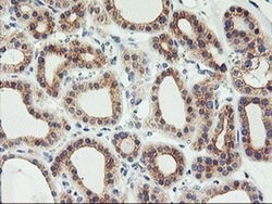 PHF21B Mouse anti-Human, Clone: OTI3D1, liquid, TrueMAB 100 &mu;L; Unconjugated:Antibodies,