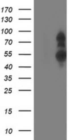 PHF21B Mouse anti-Human, Clone: OTI4C5, lyophilized, TrueMAB 100 &mu;g;
