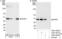 PHF6 Rabbit anti-Human, Polyclonal, Bethyl Laboratories 100 &mu;L; Unconjugated:Antibodies,