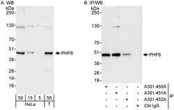 PHF6 Rabbit anti-Human, Polyclonal, Bethyl Laboratories 100 &mu;L; Unconjugated:Antibodies,