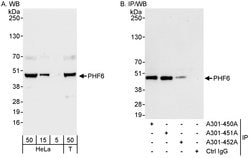 PHF6 Rabbit anti-Human, Polyclonal, Bethyl Laboratories 100 &mu;L; Unconjugated:Antibodies,