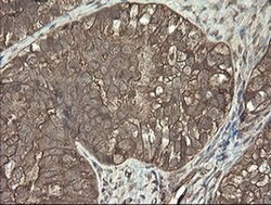 PHF7 Monoclonal Antibody (OTI1G9), TrueMAB , OriGene 100 &mu;L; Unconjugated:Antibodies,